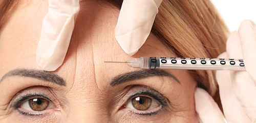 Botox-Injektionen in die Augenbrauen: wichtige Nuancen