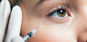 Inyecciones de Botox en el área de los ojos para combatir las arrugas.