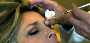 Injekcije botoxa u čelo