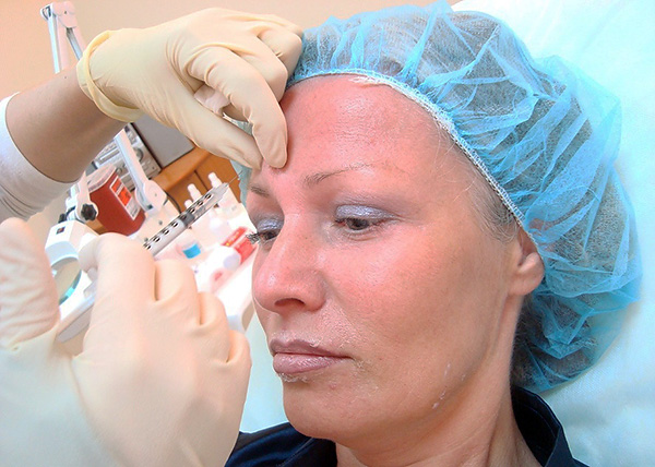 Die Verwendung von Botulax zur Glättung von Falten im Bereich der Augenbrauen