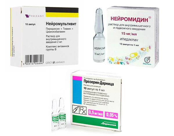 Medikamente, die manchmal zur Bekämpfung der Nebenwirkungen einer Botulinumtherapie eingesetzt werden.