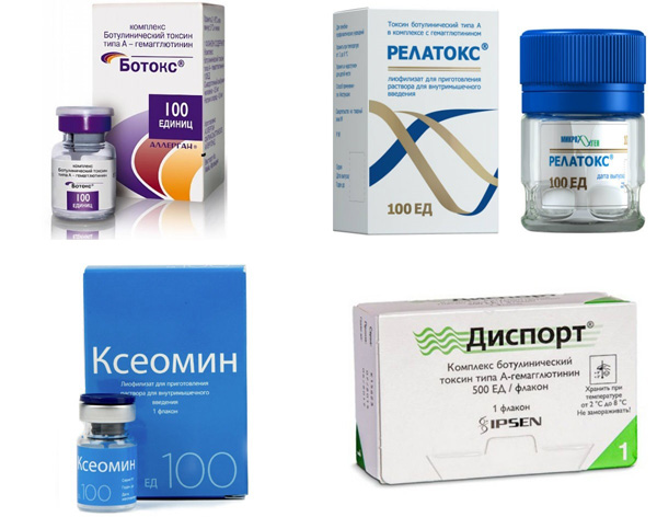 Botox, Relatox, Xeomin, Dysport dans la lutte contre les rides nasolabiales
