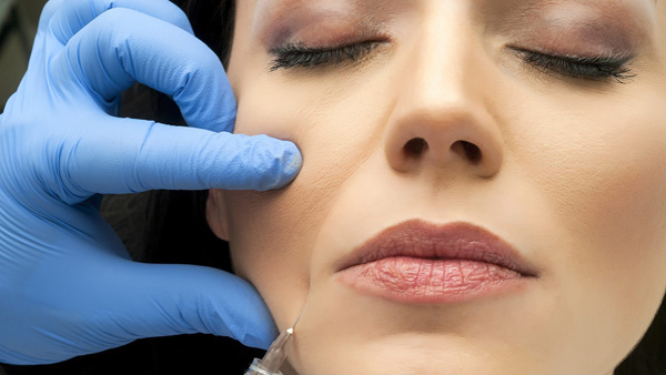 Injection de Botox dans le muscle qui abaisse les coins de la bouche