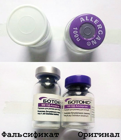 Comparaison des flacons de la préparation originale au Botox et de la contrefaçon